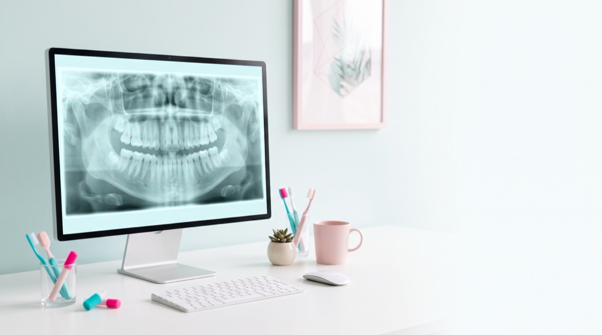 Panoramic dental X-ray on a monitor in a bright, pastel office